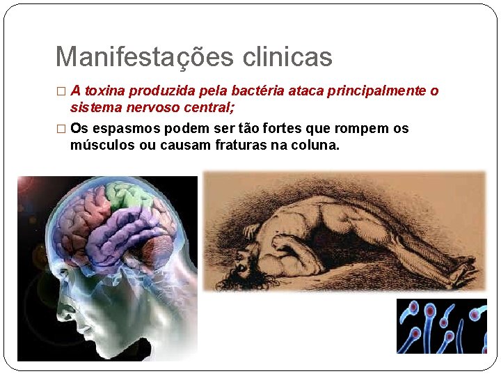 Manifestações clinicas � A toxina produzida pela bactéria ataca principalmente o sistema nervoso central;