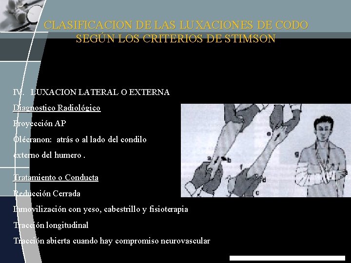 CLASIFICACION DE LAS LUXACIONES DE CODO SEGÚN LOS CRITERIOS DE STIMSON IV. LUXACION LATERAL