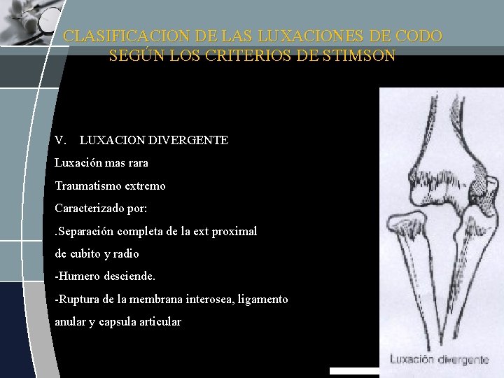 CLASIFICACION DE LAS LUXACIONES DE CODO SEGÚN LOS CRITERIOS DE STIMSON V. LUXACION DIVERGENTE