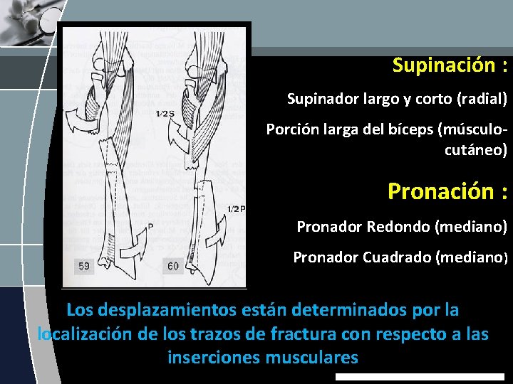 Supinación : Supinador largo y corto (radial) Porción larga del bíceps (músculocutáneo) Pronación :