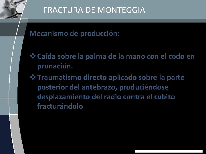 FRACTURA DE MONTEGGIA Mecanismo de producción: v Caída sobre la palma de la mano