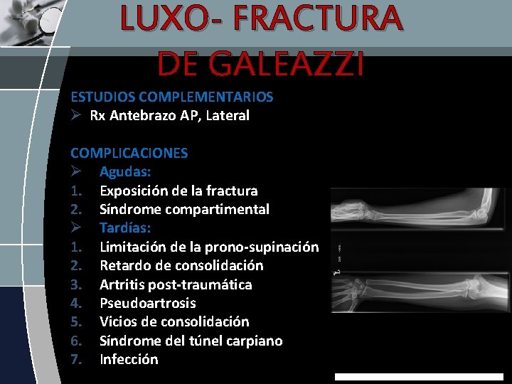 LUXO- FRACTURA DE GALEAZZI ESTUDIOS COMPLEMENTARIOS Ø Rx Antebrazo AP, Lateral COMPLICACIONES Ø Agudas: