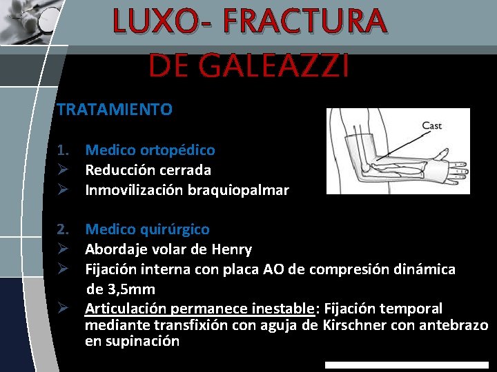 LUXO- FRACTURA DE GALEAZZI TRATAMIENTO 1. Medico ortopédico Ø Reducción cerrada Ø Inmovilización braquiopalmar