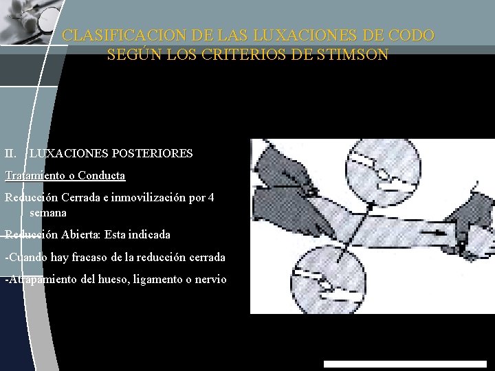 CLASIFICACION DE LAS LUXACIONES DE CODO SEGÚN LOS CRITERIOS DE STIMSON II. LUXACIONES POSTERIORES