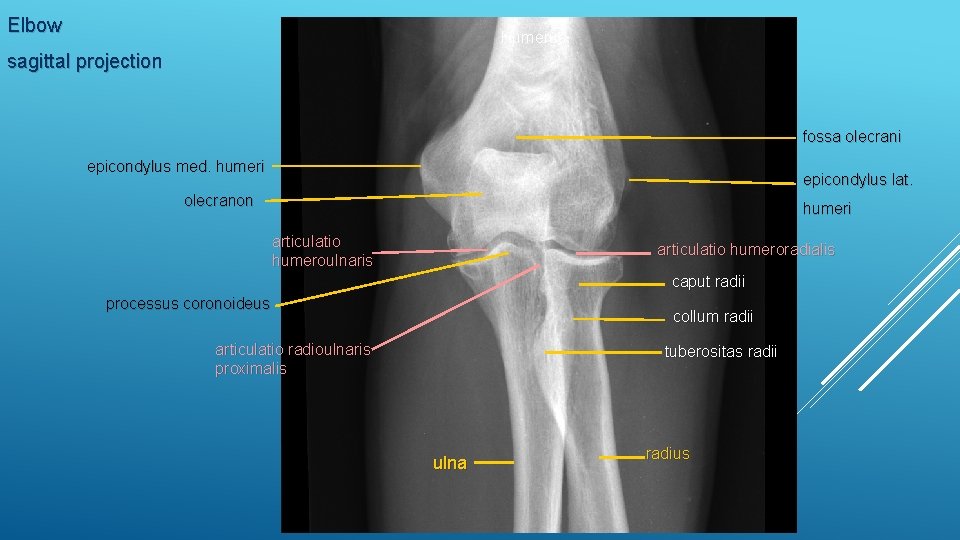 Elbow Humerus sagittal projection fossa olecrani epicondylus med. humeri epicondylus lat. olecranon humeri articulatio