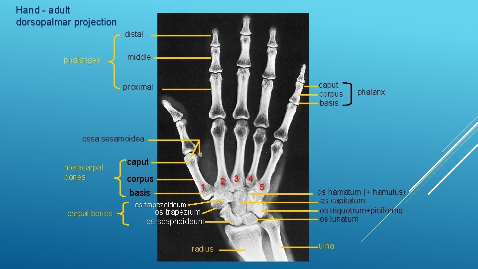 Hand - adult dorsopalmar projection distal phalanges middle caput corpus basis proximal phalanx ossa