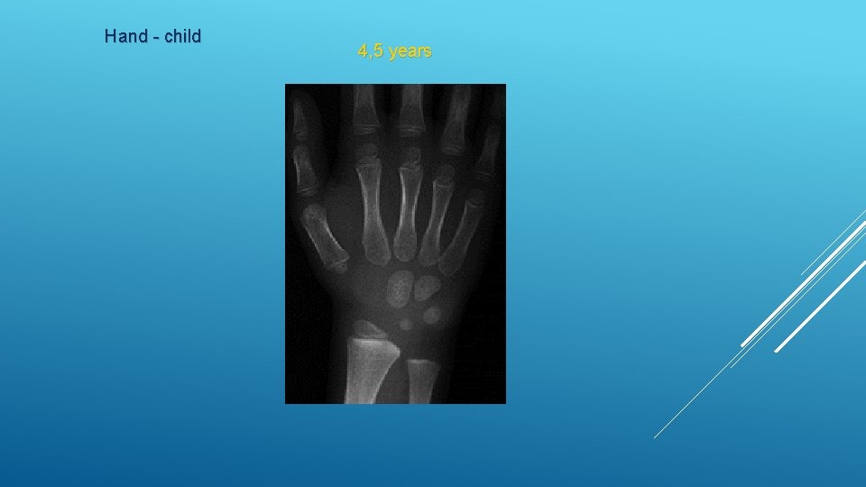 Hand - child 4, 5 years 