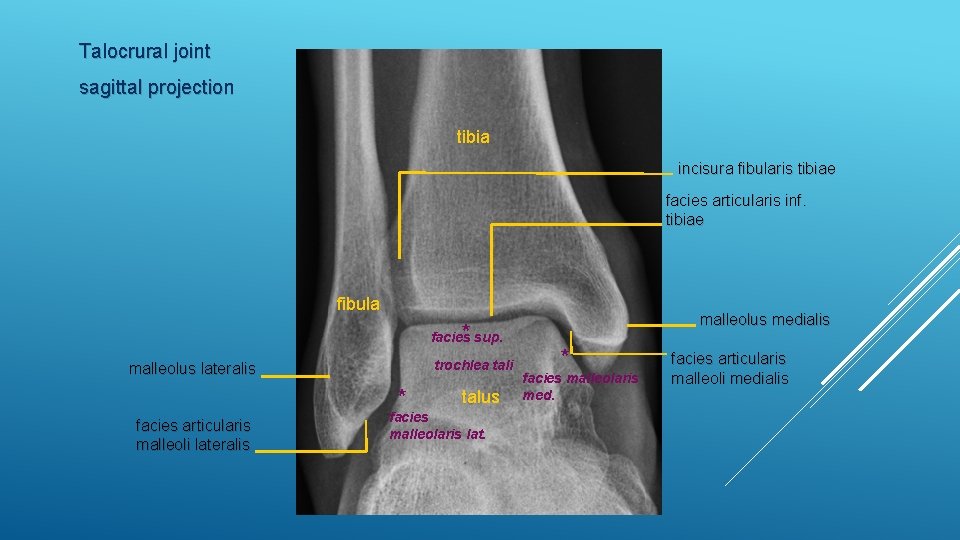 Talocrural joint sagittal projection tibia incisura fibularis tibiae facies articularis inf. tibiae fibula *