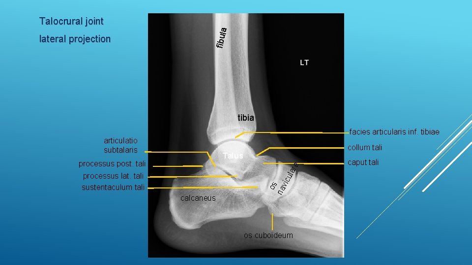 lateral projection fibula Talocrural joint tibia facies articularis inf. tibiae articulatio subtalaris collum tali