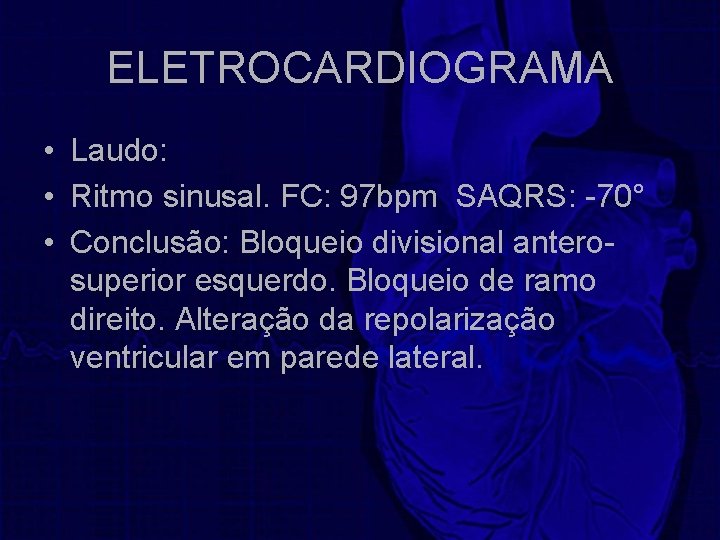 ELETROCARDIOGRAMA • Laudo: • Ritmo sinusal. FC: 97 bpm SAQRS: -70° • Conclusão: Bloqueio