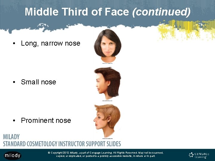 Middle Third of Face (continued) • Long, narrow nose • Small nose • Prominent