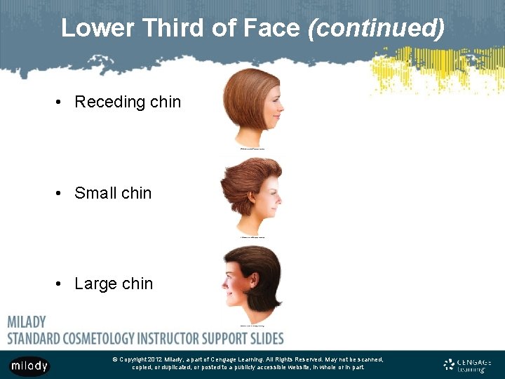 Lower Third of Face (continued) • Receding chin • Small chin • Large chin