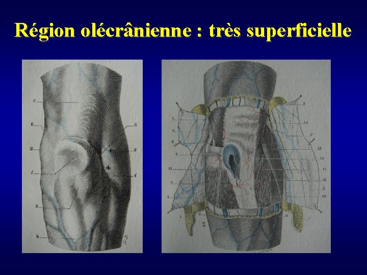 Région olécrânienne : très superficielle 