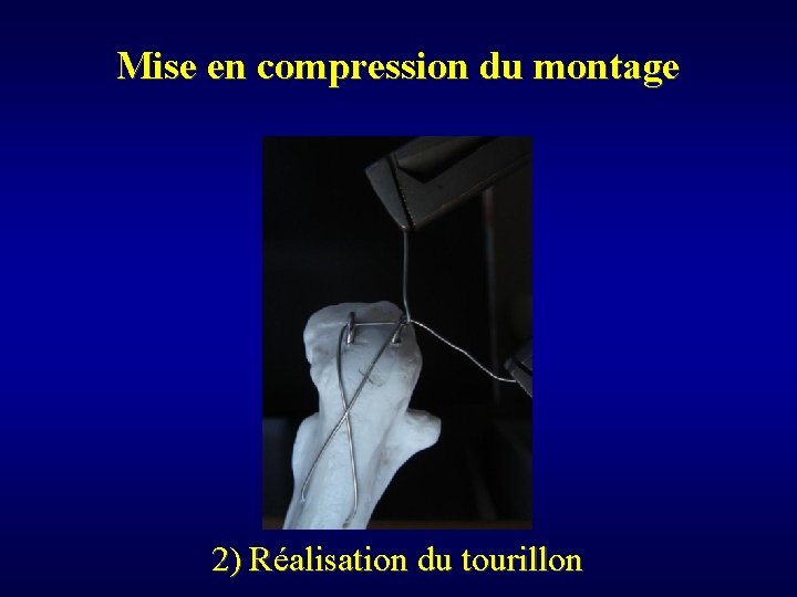 Mise en compression du montage 2) Réalisation du tourillon 