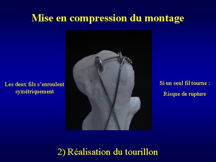Mise en compression du montage Les deux fils s’enroulent symétriquement 2) Réalisation du tourillon