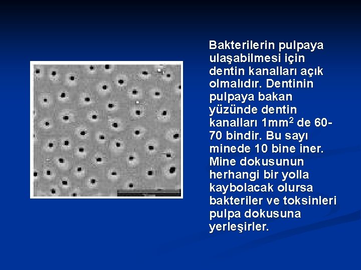 Bakterilerin pulpaya ulaşabilmesi için dentin kanalları açık olmalıdır. Dentinin pulpaya bakan yüzünde dentin kanalları