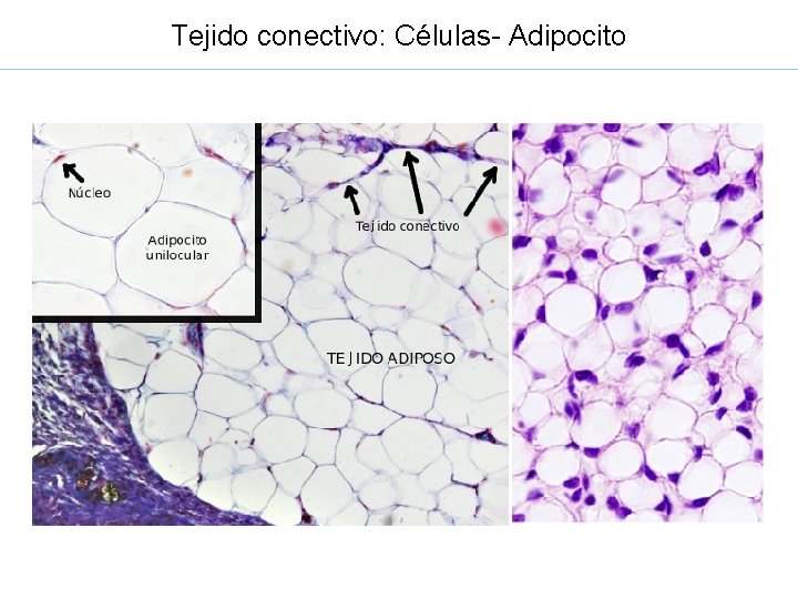 Tejido conectivo: Células- Adipocito 