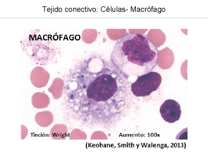 Tejido conectivo: Células- Macrófago 