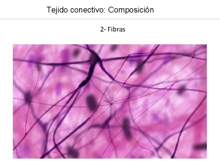 Tejido conectivo: Composición 2 - Fibras 