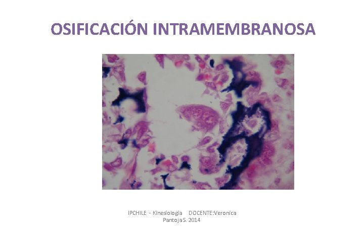 OSIFICACIÓN INTRAMEMBRANOSA IPCHILE - Kinesiologia DOCENTE: Veronica Pantoja S. 2014 