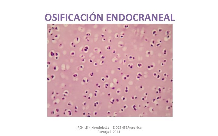 OSIFICACIÓN ENDOCRANEAL IPCHILE - Kinesiologia DOCENTE: Veronica Pantoja S. 2014 