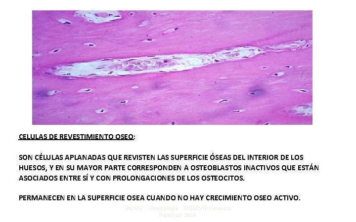 CELULAS DE REVESTIMIENTO OSEO: SON CÉLULAS APLANADAS QUE REVISTEN LAS SUPERFICIE ÓSEAS DEL INTERIOR