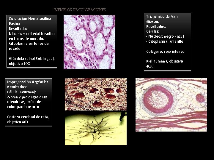 EJEMPLOS DE COLORACIONES Coloración Hematoxilina. Eosina Resultados: Núcleos y material basófilo en tonos de