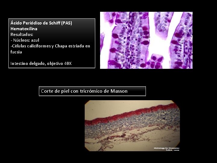 Ácido Periódico de Schiff (PAS) Hematoxilina Resultados: - Núcleos: azul -Células caliciformes y Chapa