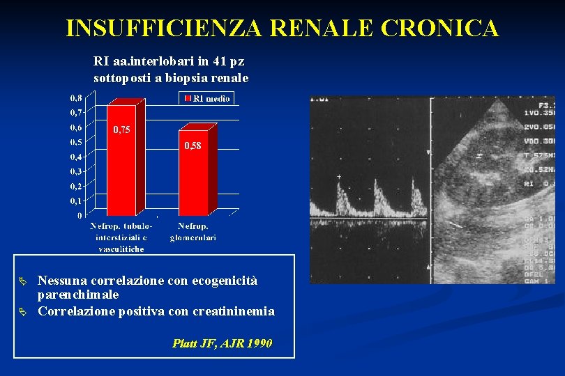 INSUFFICIENZA RENALE CRONICA RI aa. interlobari in 41 pz sottoposti a biopsia renale 0,