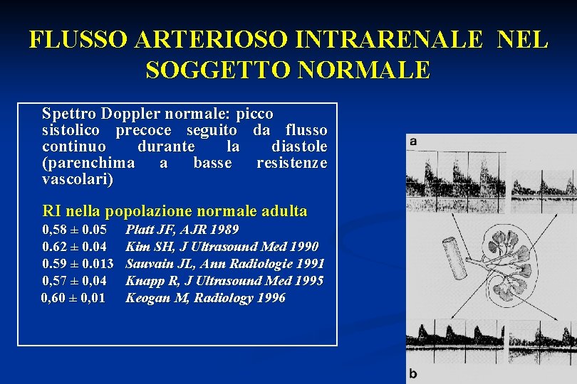 FLUSSO ARTERIOSO INTRARENALE NEL SOGGETTO NORMALE Spettro Doppler normale: picco sistolico precoce seguito da