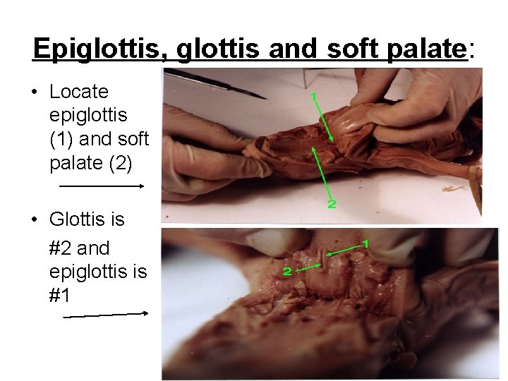 Epiglottis, glottis and soft palate: • Locate epiglottis (1) and soft palate (2) •