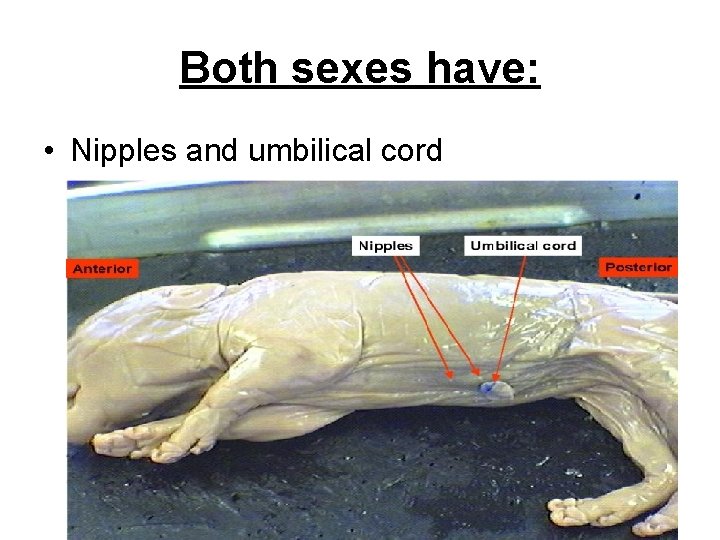 Both sexes have: • Nipples and umbilical cord 