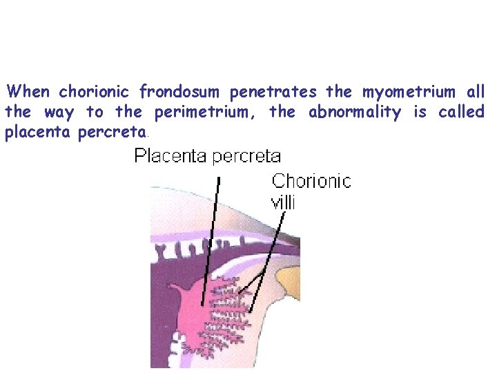 When chorionic frondosum penetrates the myometrium all the way to the perimetrium, the abnormality