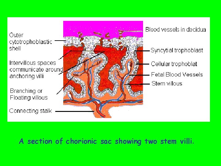  A section of chorionic sac showing two stem villi. 