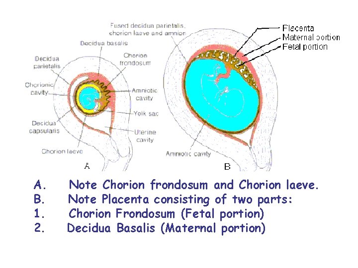  A. Note Chorion frondosum and Chorion laeve. B. Note Placenta consisting of two