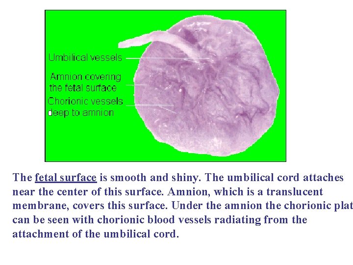  The fetal surface is smooth and shiny. The umbilical cord attaches near the