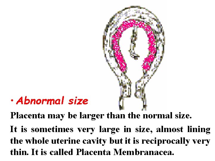  • Abnormal size Placenta may be larger than the normal size. It is