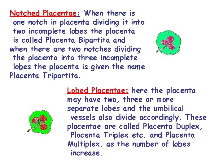Notched Placentae: When there is one notch in placenta dividing it into two incomplete