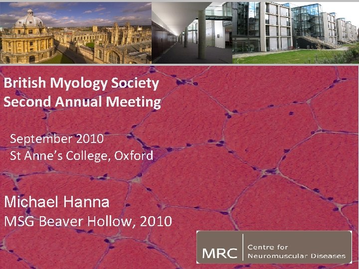 British Myology Society Second Annual Meeting September 2010 St Anne’s College, Oxford Michael Hanna