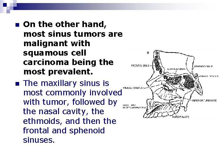 n n On the other hand, most sinus tumors are malignant with squamous cell