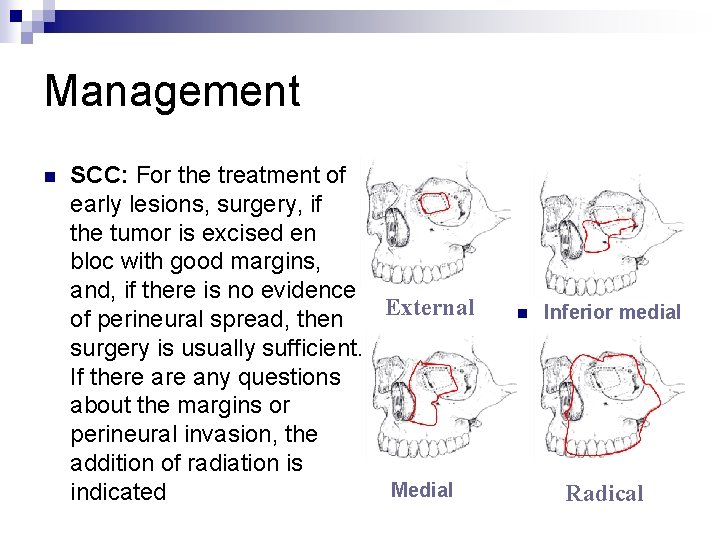 Management n SCC: For the treatment of early lesions, surgery, if the tumor is
