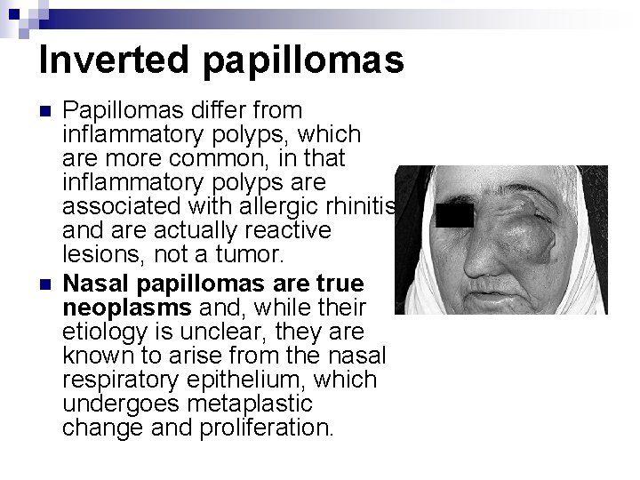 difference between inverted papilloma and polyp)