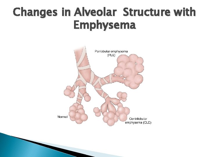 Changes in Alveolar Structure with Emphysema 