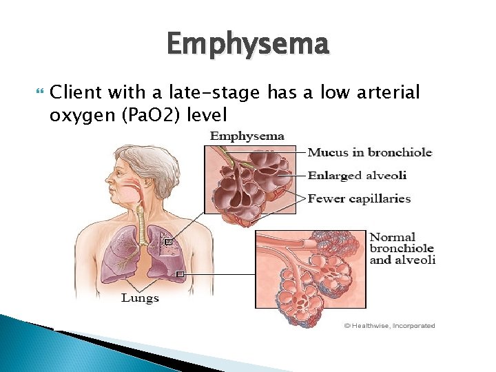 Emphysema Client with a late-stage has a low arterial oxygen (Pa. O 2) level