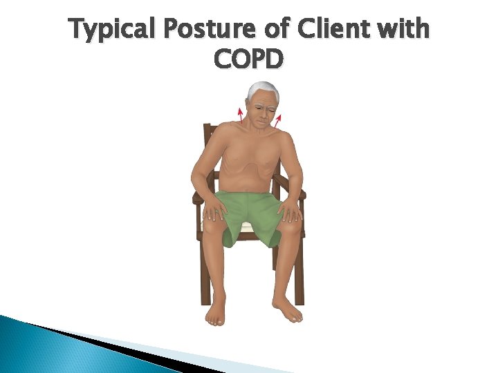 Typical Posture of Client with COPD 