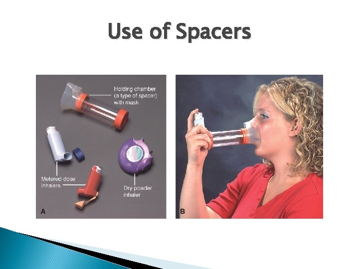 Use of Spacers 