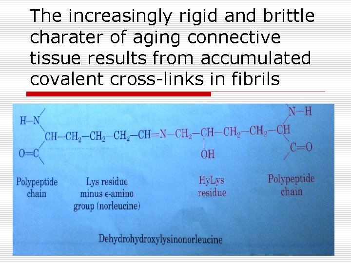 The increasingly rigid and brittle charater of aging connective tissue results from accumulated covalent