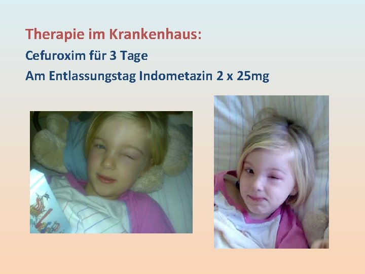 Therapie im Krankenhaus: Cefuroxim für 3 Tage Am Entlassungstag Indometazin 2 x 25 mg Therapie im Krankenhaus: Cefuroxim für 3 Tage Am Entlassungstag Indometazin 2 x 25 mg