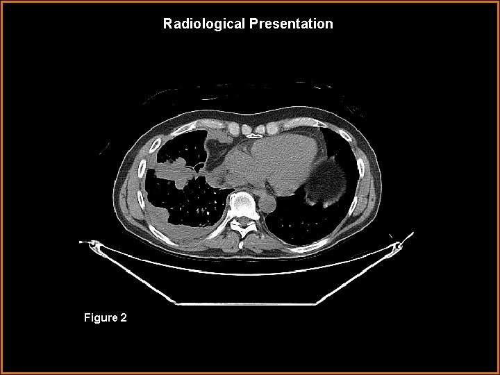 Radiological Presentation Figure 2 