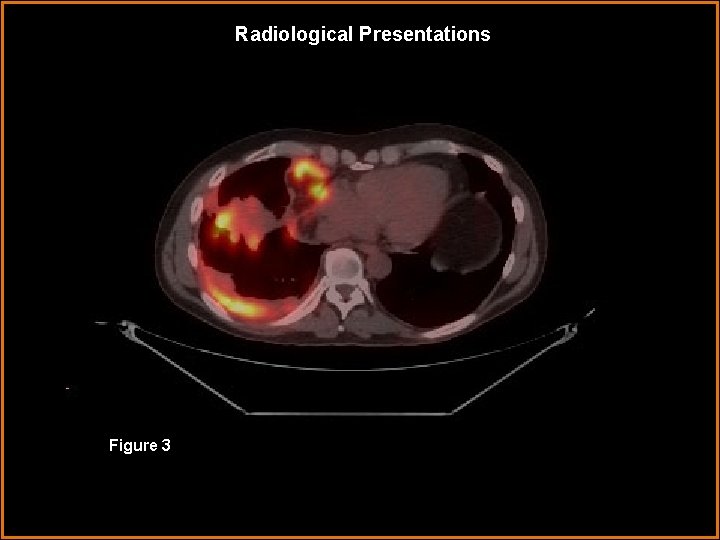 Radiological Presentations Figure 3 